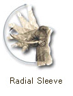 Radial Sleeve